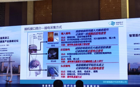 千亿级市场规模！融合智慧医疗，脑机接口技术迎来市场拐点