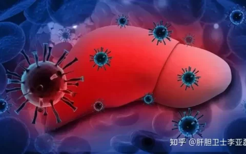 肝上有结节怎么治疗？(肝部结节病治疗)