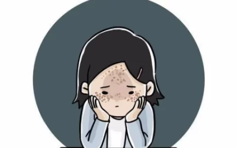 面部长斑的原因和应对措施你了解多少？-面部长斑怎么回事