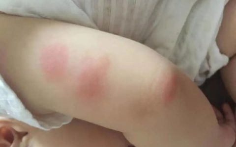 九成人不知晓蟑螂“怕”的是什么？教你家里放点“它”，蟑螂“快速消失”-蟑螂比较怕什么植物