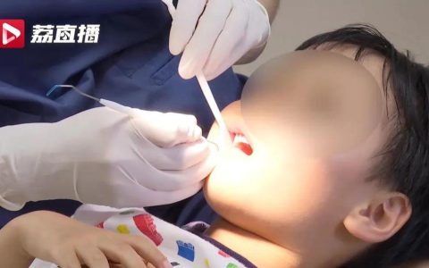 用牙膏就可以补牙洞？10岁女孩牙洞没补成，“损失”6颗牙！​（牙膏可以补裂缝吗）