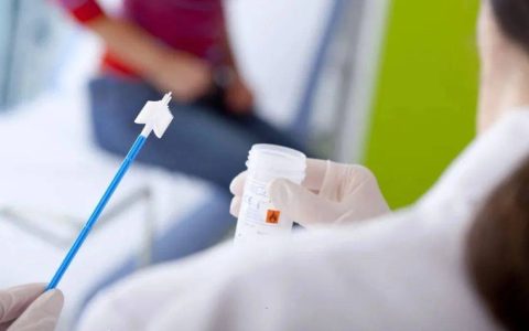 HPV阴性TCT异常需要进一步检查吗？-hpv阴性tct会有异常吗