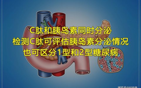 好安森糖尿病治疗仪：什么是C肽？检测C肽的作用是什么？