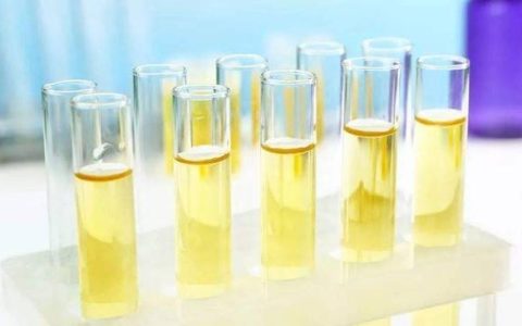 家佳诊： 尿液干化学检查原来有这么多的影响因素(尿液干化学检查的常见项目)